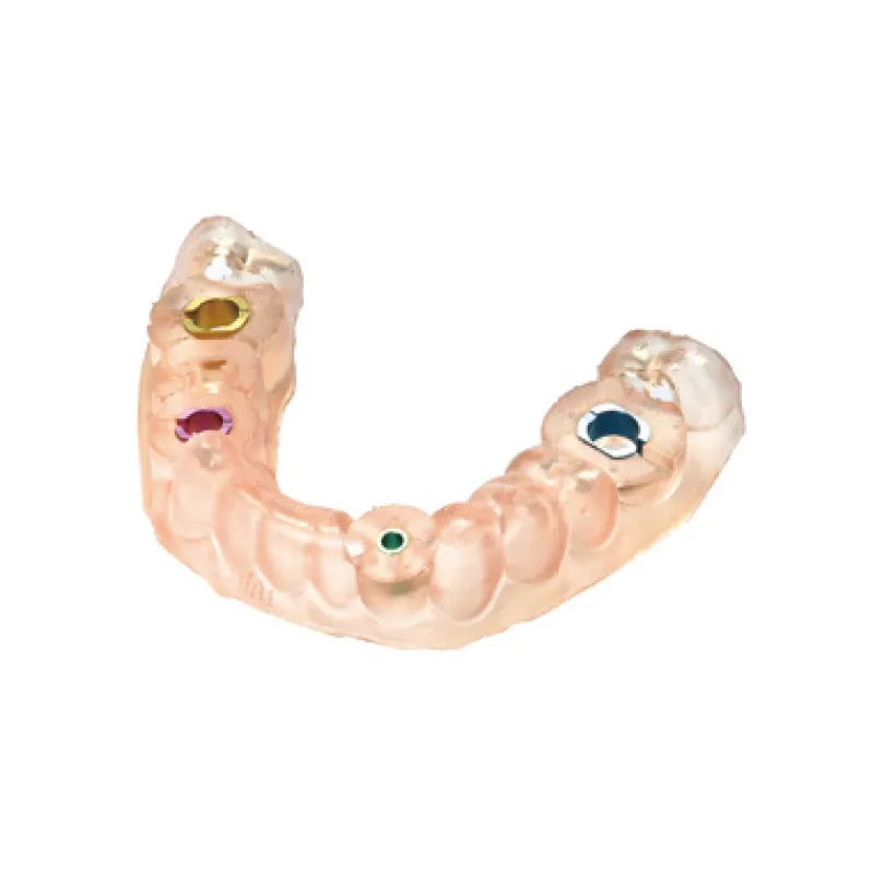 インプラントの流れ