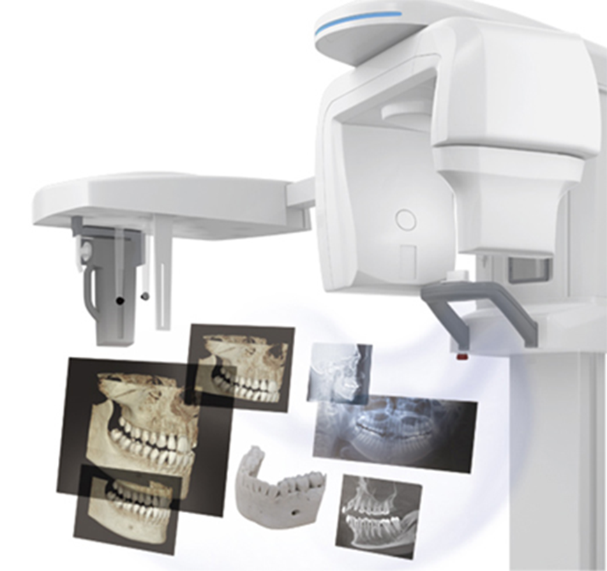 インプラントの流れ