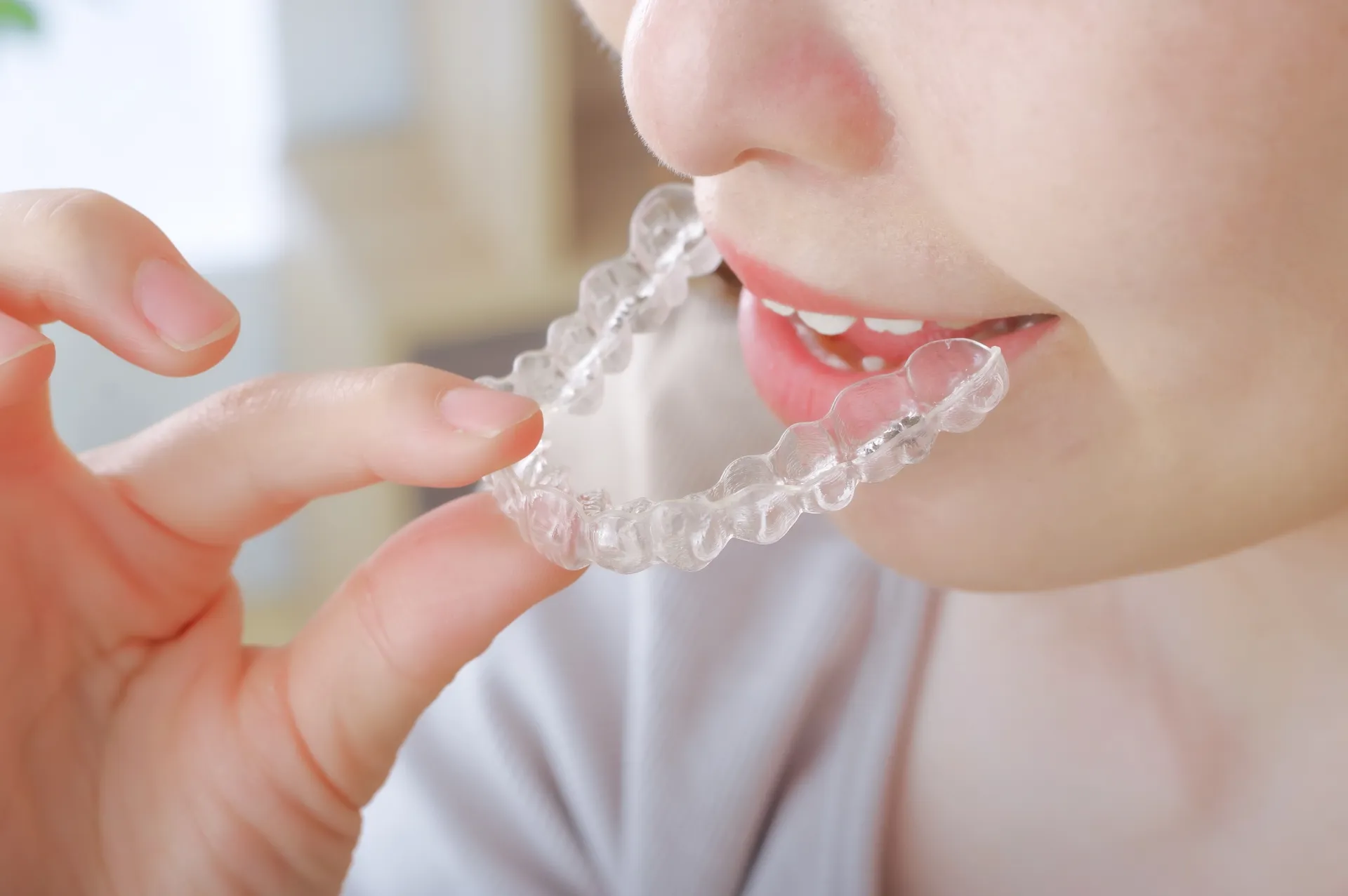 ナイトガード（歯ぎしり・顎関節症対策）